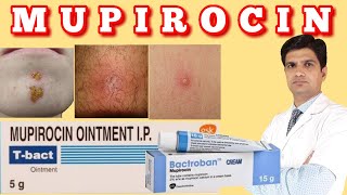 T bact ointment  Bactroban ointment  Mupirocin ointment uses side effects how to apply [upl. by Adnorehs]