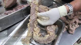 Anatomy Dissection of Large amp Small Intestine [upl. by Alegnaoj56]