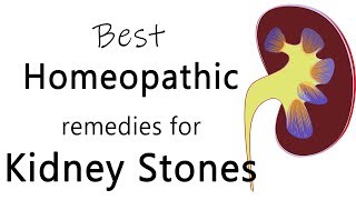 Best homeopathic medicine for stone in kidney  Dr Sanjay Panicker [upl. by Akiraa]