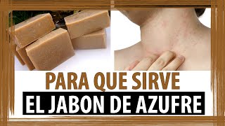 PARA QUE SIRVE EL JABON DE AZUFRE [upl. by Nylad]