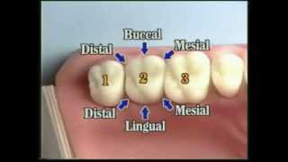 V109 Patient Records Management amp Dental Charting [upl. by Arrimat]