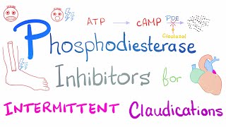 Intermittent Claudications Management [upl. by Lyrem805]