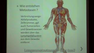 Lungenmetastasen – und nun  Dr med B Enderes [upl. by Ainoval703]